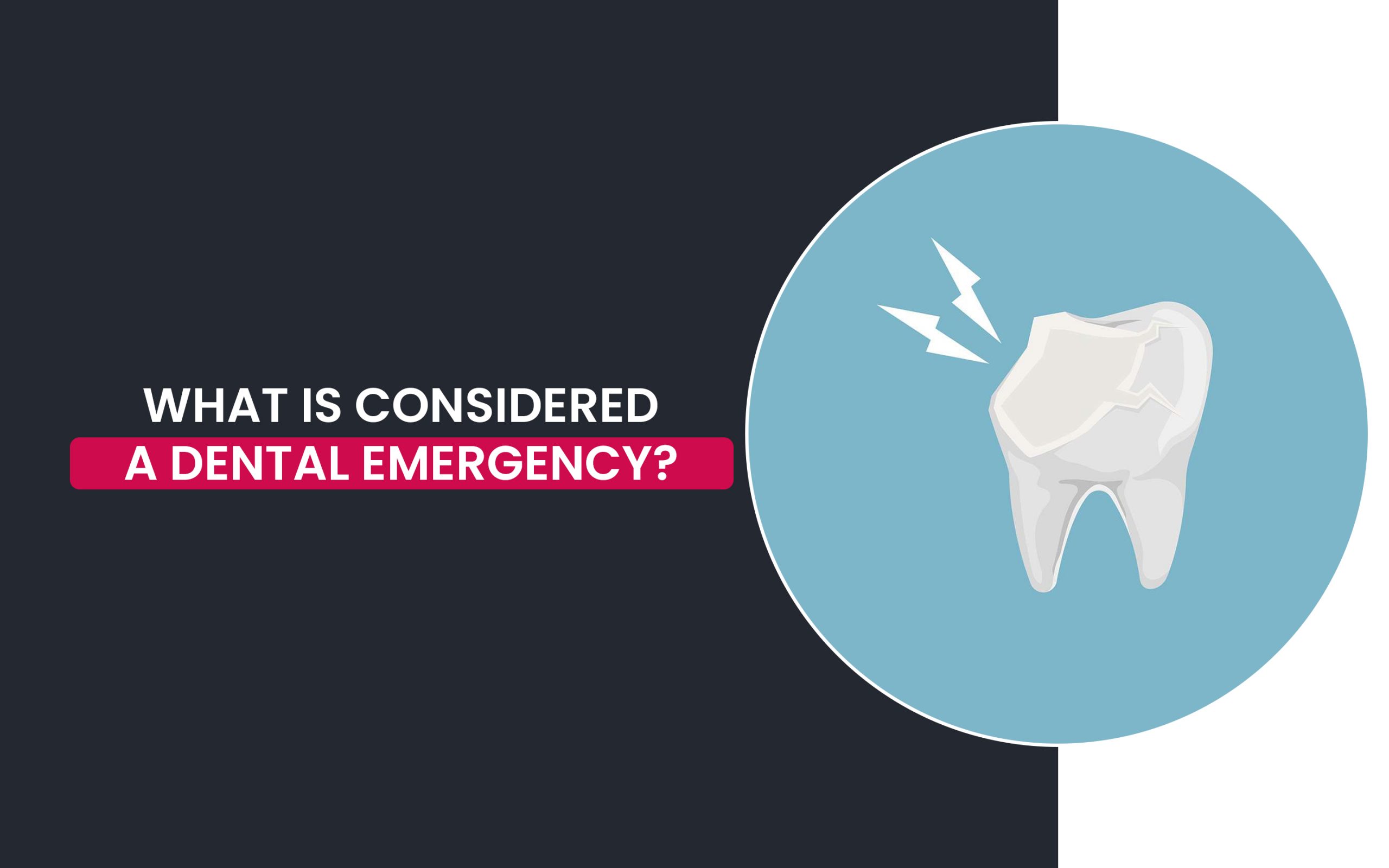 What is dental emergency