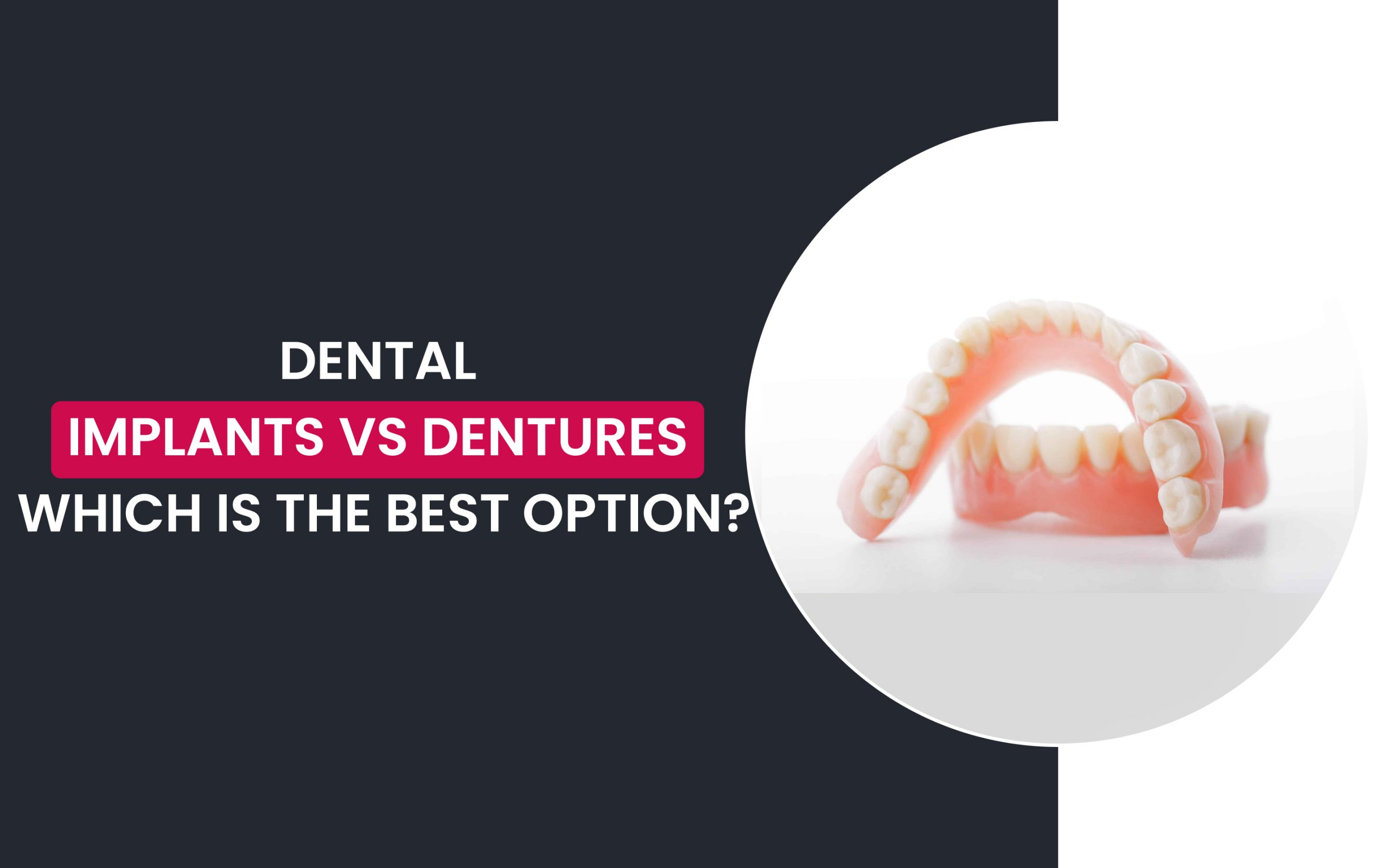 Dental implants vs dentures