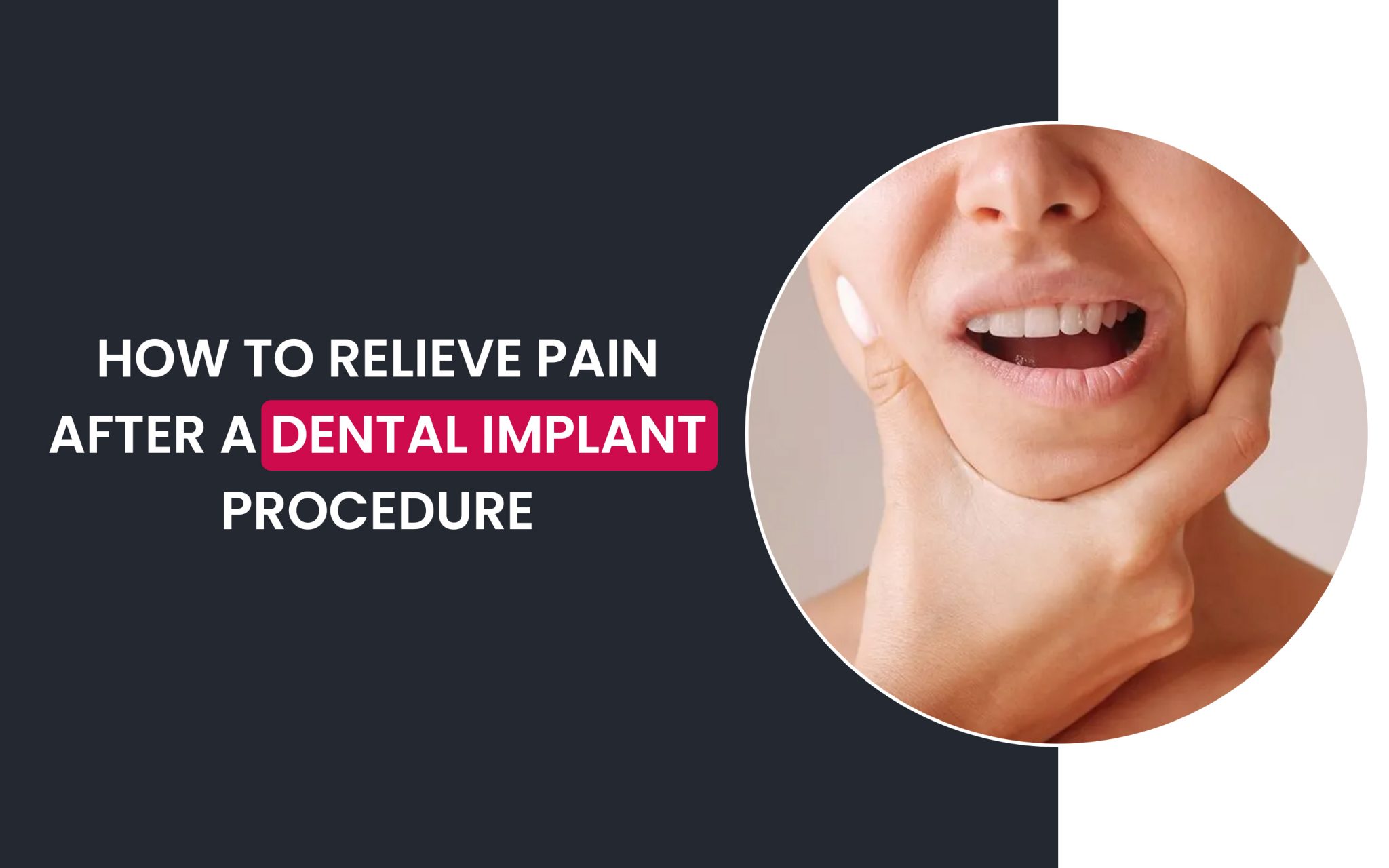 How to Relieve Pain after Dental Implant Procedure