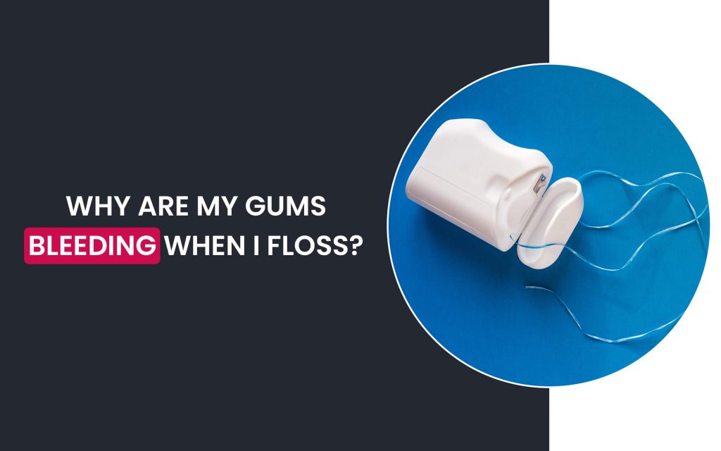 Gum bleeding when floss
