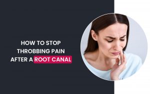 stop throbbing pain after a root canal