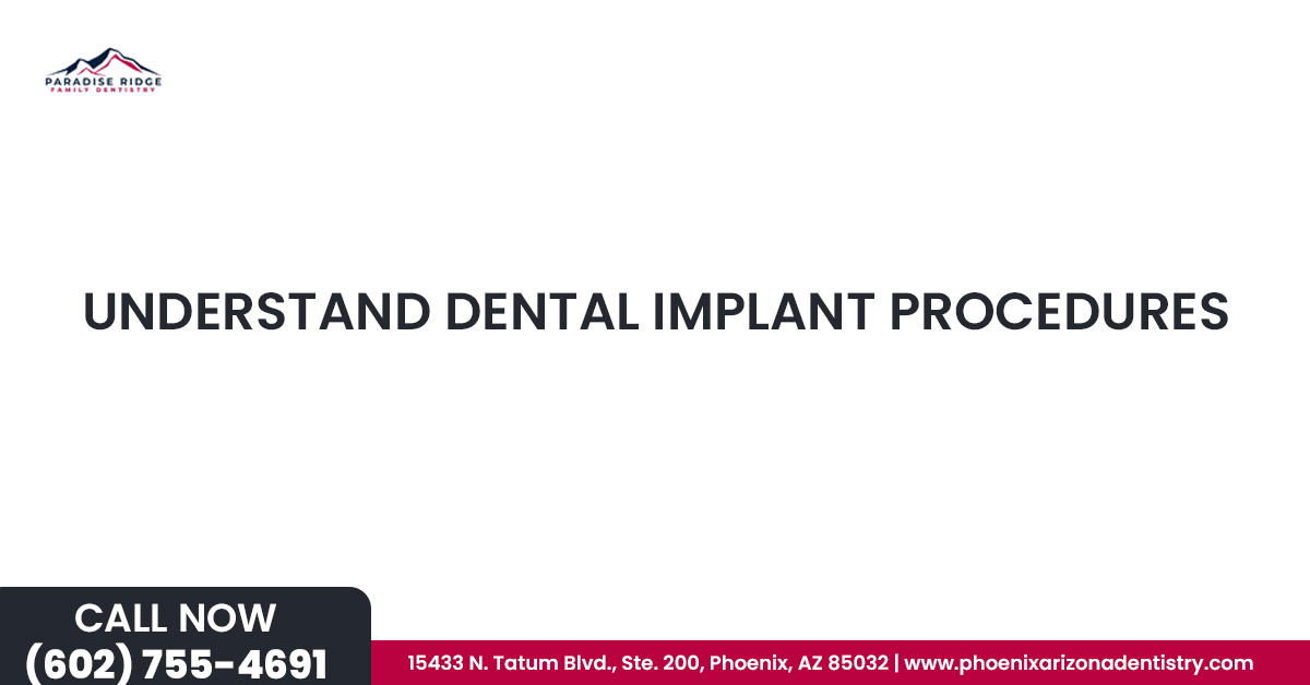 Understand Dental Implant Procedures