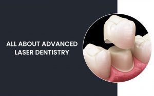 All About Advanced Laser Dentistry