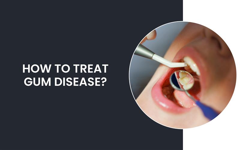 How to Treat Gum Disease