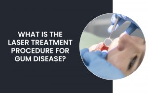 What is The Laser Treatment Procedure For Gum Disease | Paradise Ridge Dentistry What is The Laser Treatment Procedure For Gum Disease