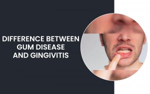 Difference Between Gum Disease And Gingivitis | Paradise Ridge Dentistry Difference Between Gum Disease And Gingivitis