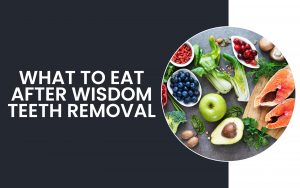 What To Eat After WTR | Paradise Ridge Dentistry What To Eat After WTR