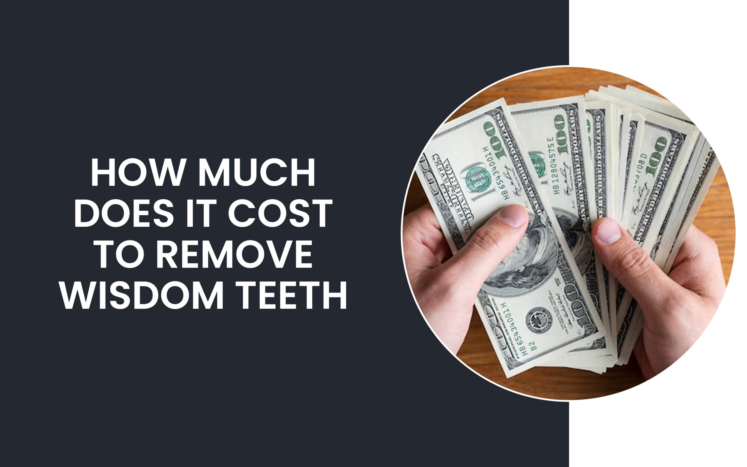 How Much Does It Cost To Remove Wisdom Teeth