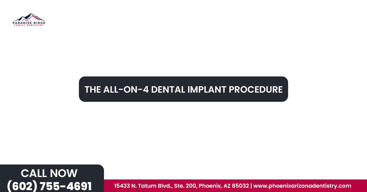 The All on 4 Dental Implant Procedure